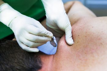 fisioterapia vallecas cervical